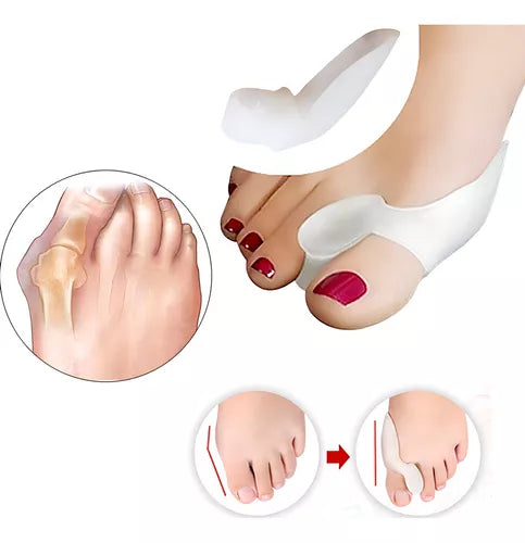 Protector De Juanetes Corrector Ortopédico De Gel De Silicona Par